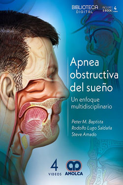 Apnea Obstructiva del Sueño