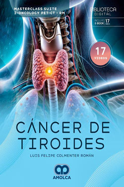 Cáncer de Tiroides