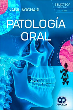 Patología Oral