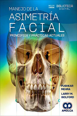 Manejo de la Asimetría Facial