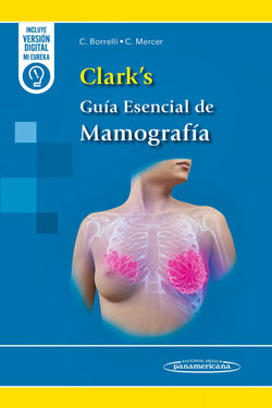 CLARK´s Guía Esencial de Mamografía