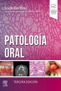 Patología Oral