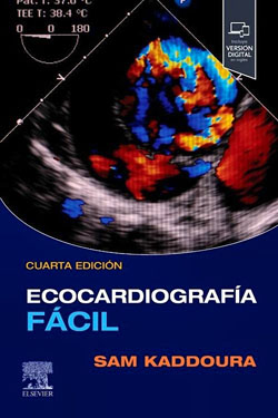 Ecocardiografi?a Fa?cil