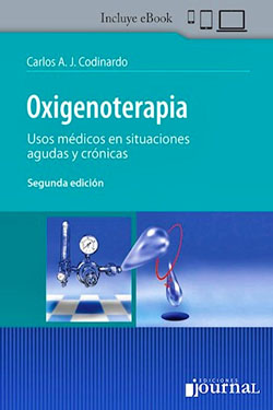 Oxigenoterapia