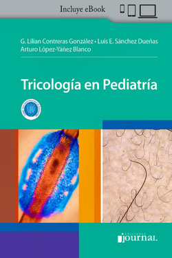 Tricología en Pediatría