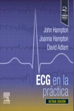 ECG en la Práctica